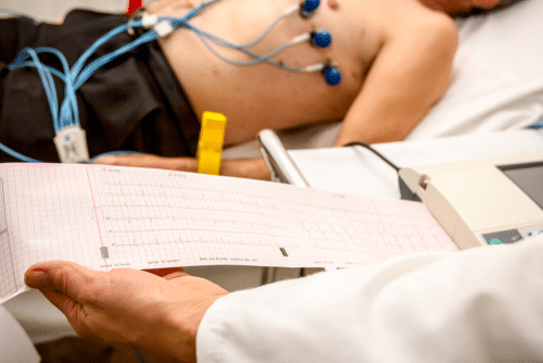 ecg-in-east-delhi